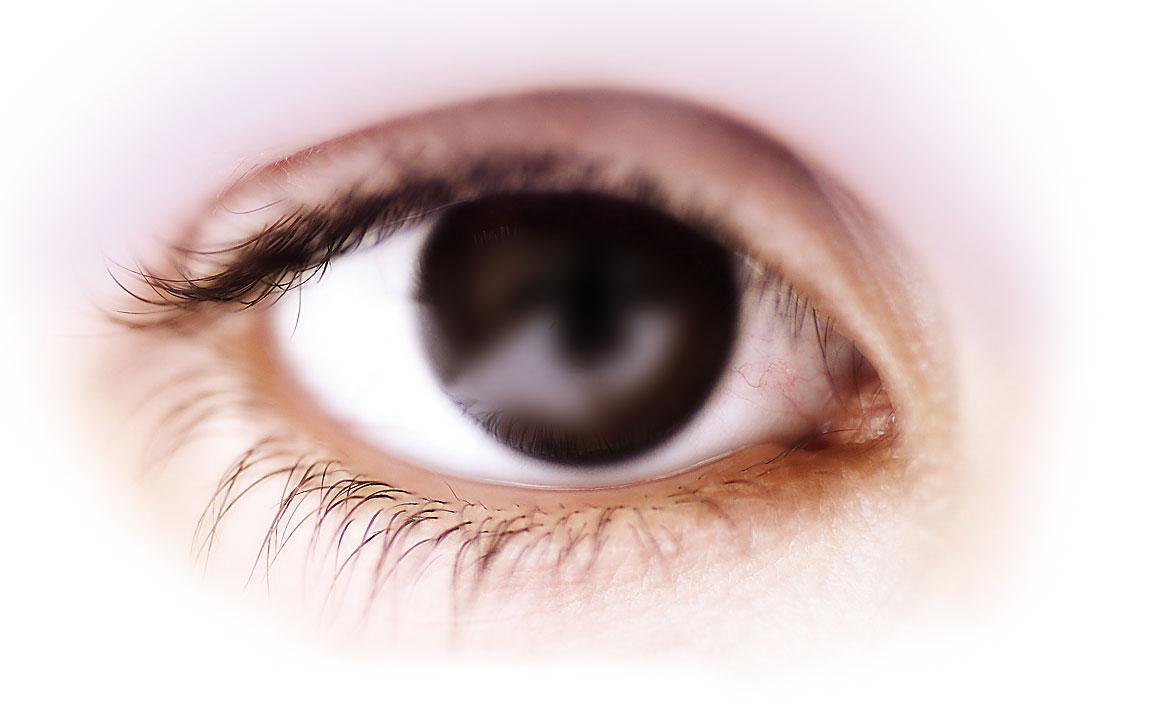 glaucoma